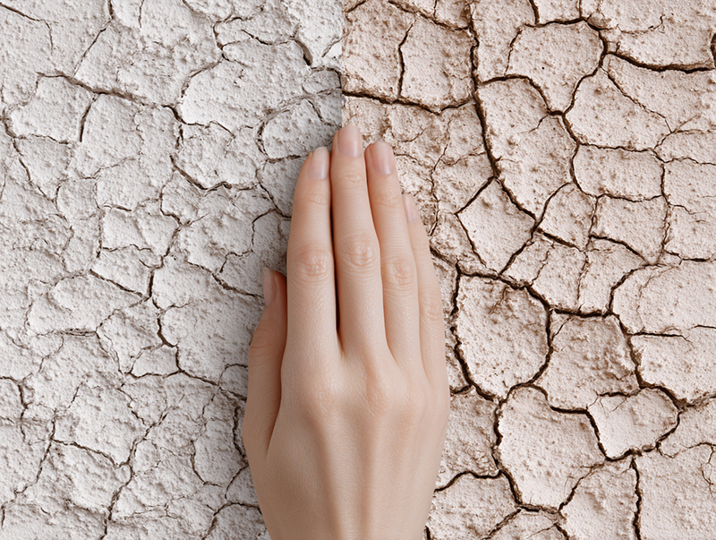 Split illustration comparing dry skin (low oil) and dehydrated skin (low water), showing texture and hydration differences
