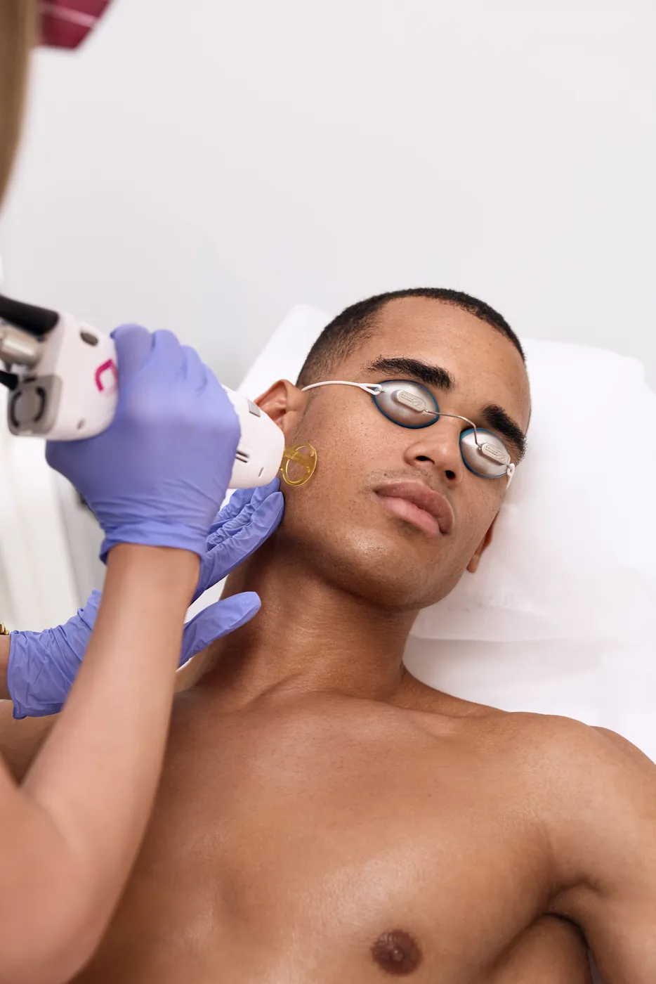 Men's laser hair removal on the face at Bogat Aesthetics & Wellness in Hallandale Beach, FL.