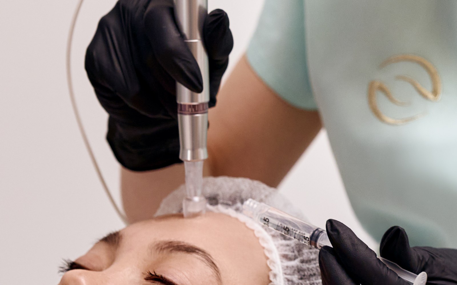 Close-up of a microneedling pen with a disposable needle cartridge at a client's forehead